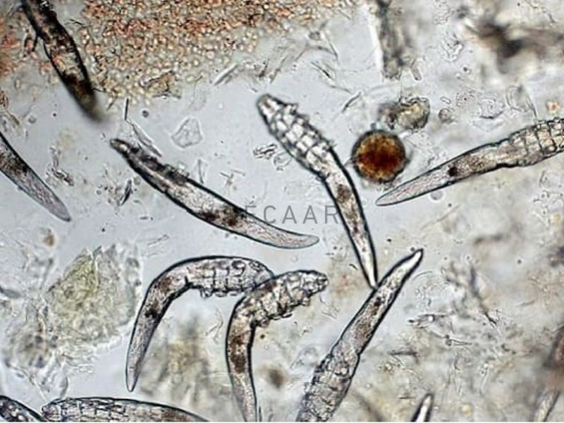 Kí sinh trùng Demodex